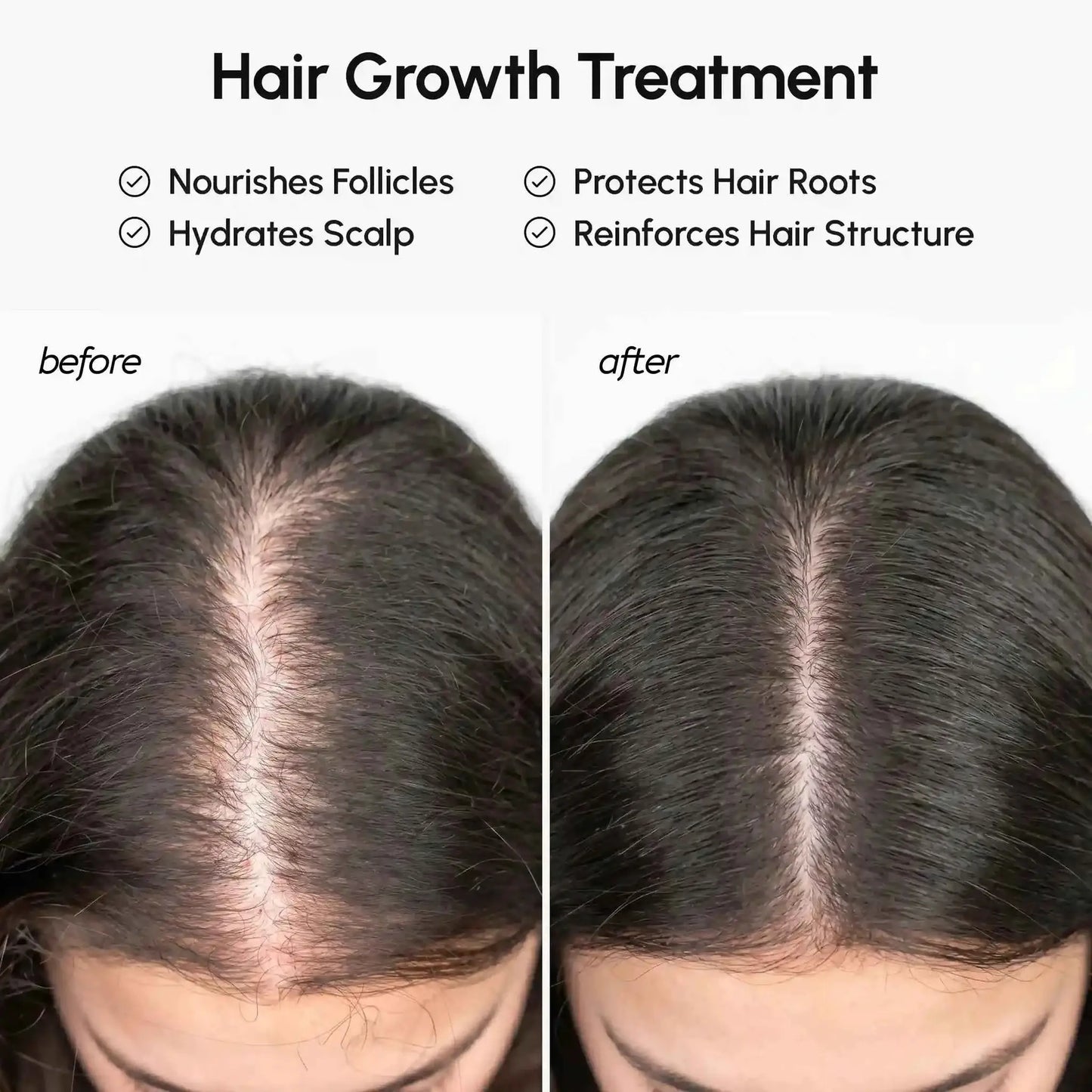 Marée Batana Hair Growth Paste by RadiantRoots; four-panel before and after scalp coverage collage