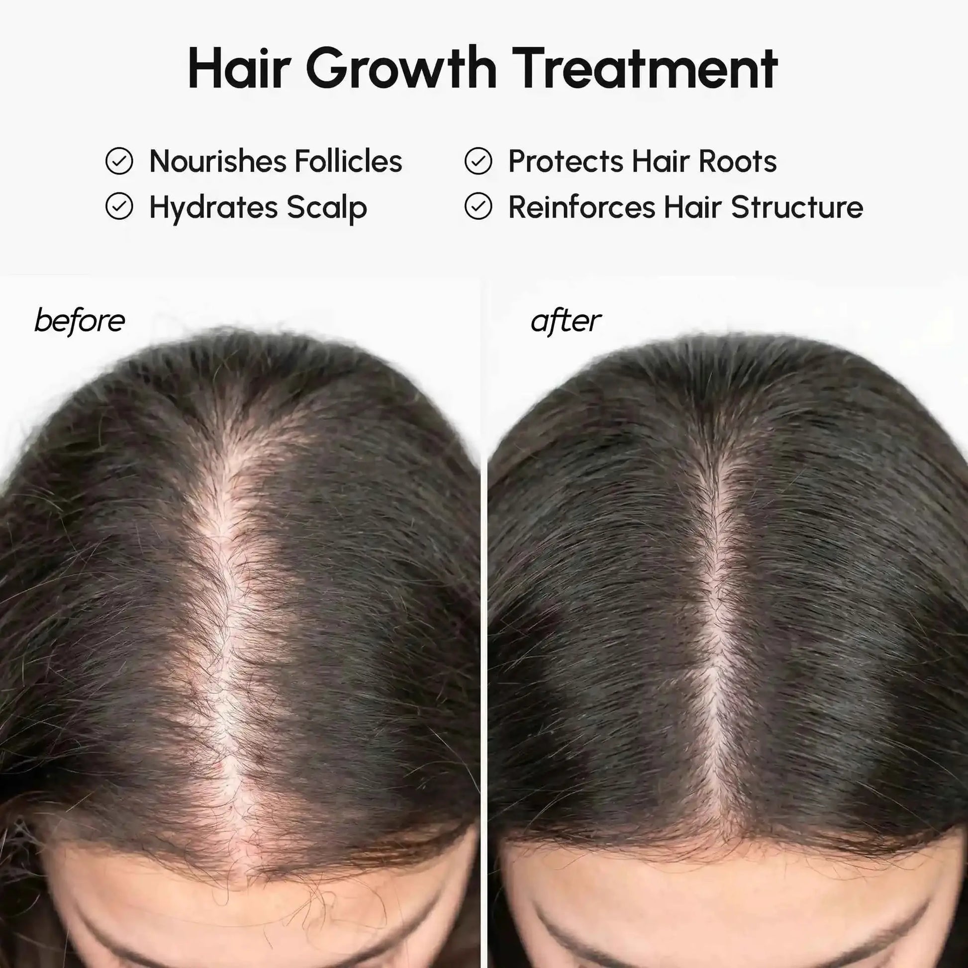 Marée Batana Hair Growth Paste by RadiantRoots; four-panel before and after scalp coverage collage