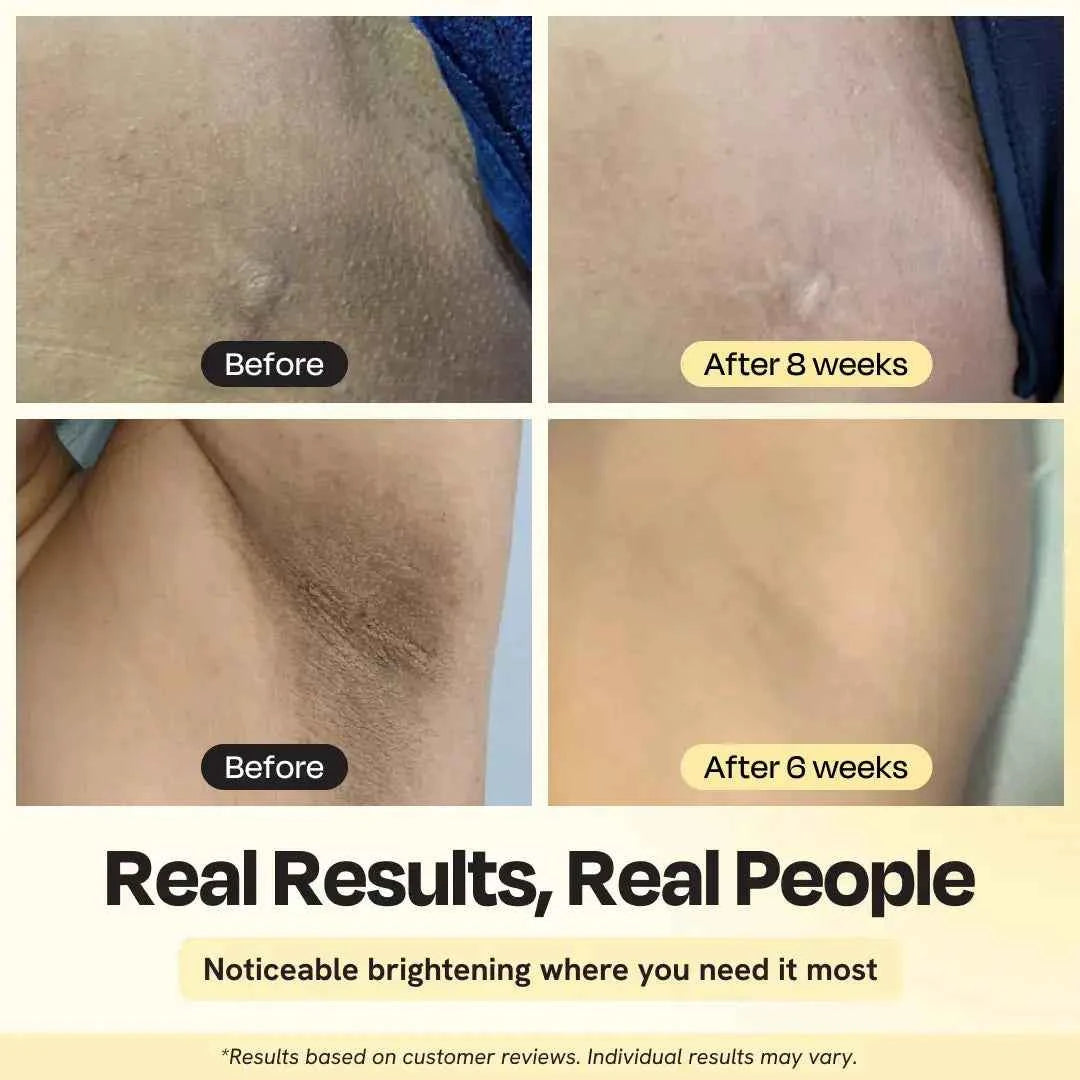 Intimate Skin Brightening Serum for Bikini Line and Underarms
