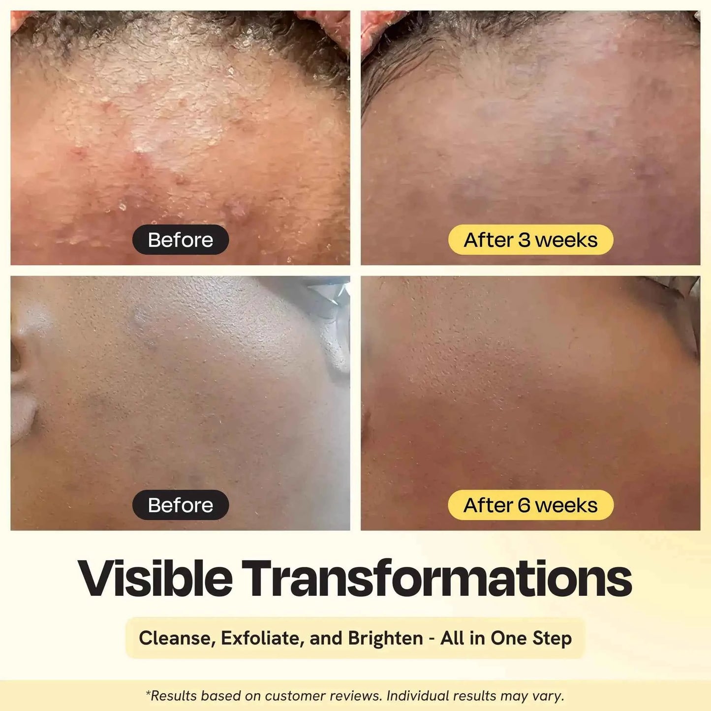 Clarifying Brightening Cleanser With Two Percent Salicylic Acid AHA PHA