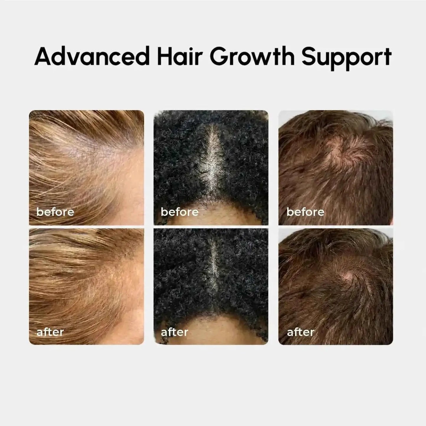 Maree 4-in-1 Hair Growth Spray hair loss treatment before and after results grid with six panels