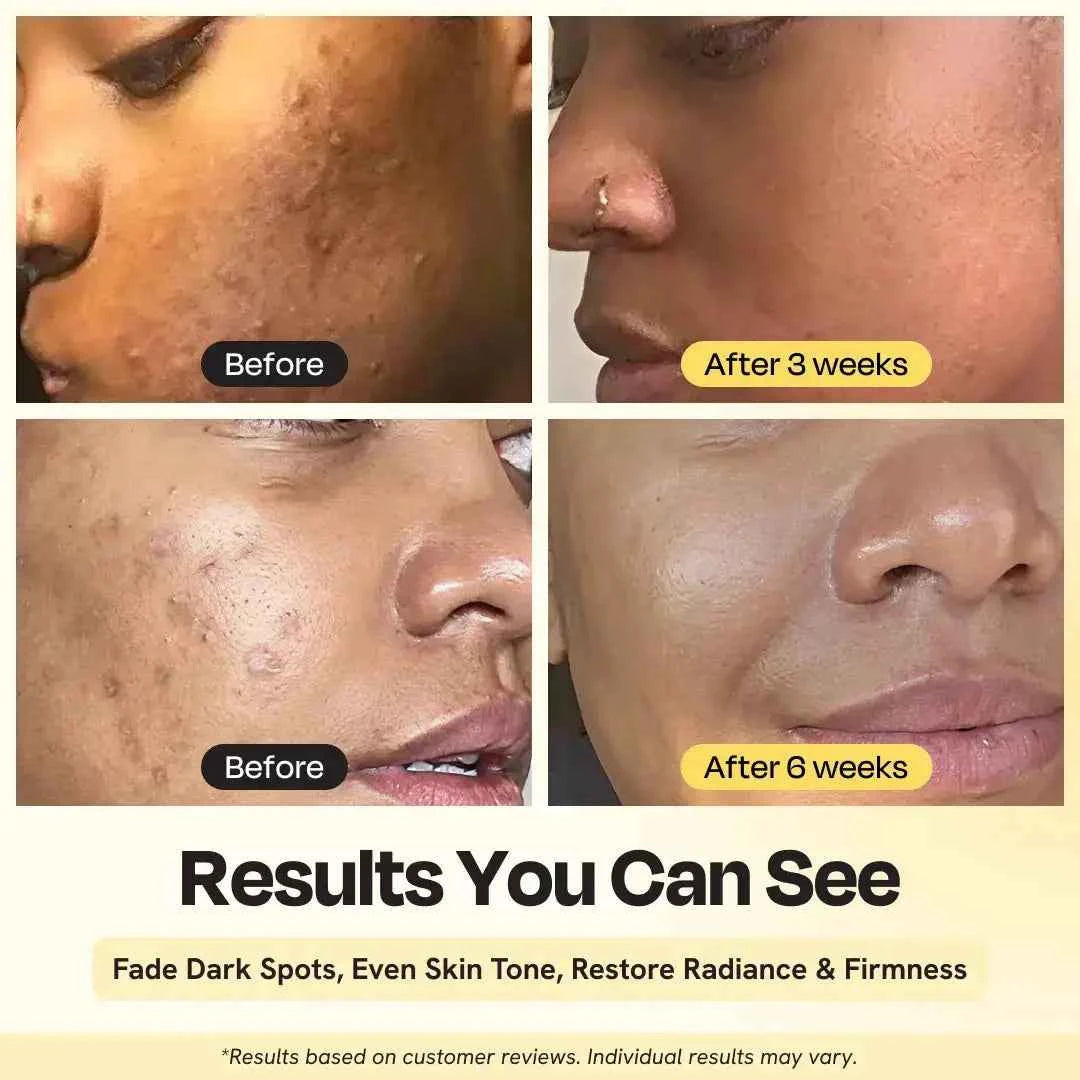 Superactive Serum 15 Percent Vitamin C For Brighter Firm Skin