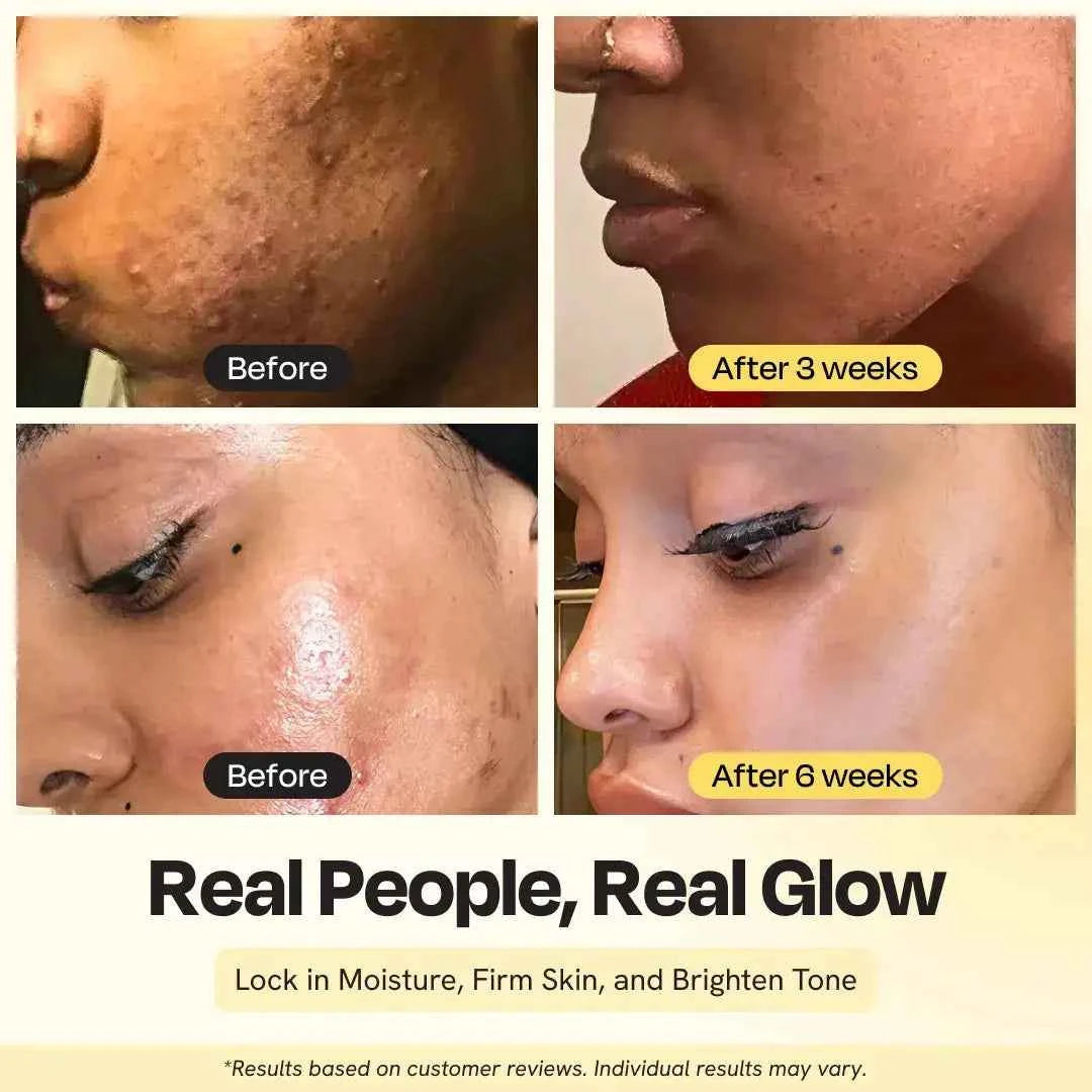 Supernutrient Facial Oil for Hydration and Radiant Firm Skin